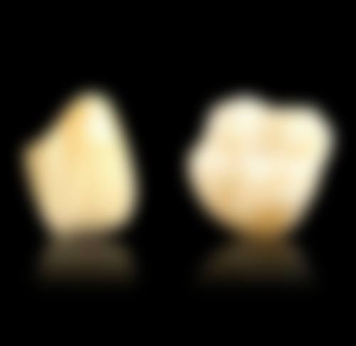 五、惠州斯迈尔口腔收费价格表