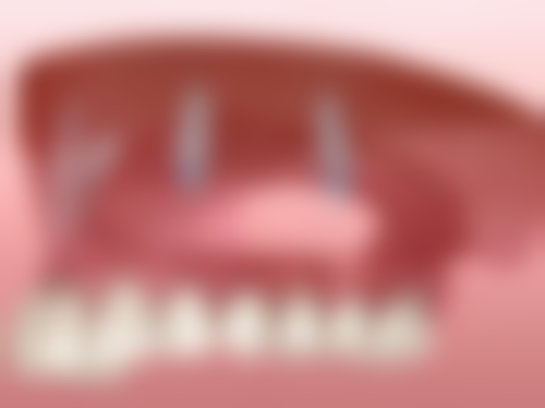 特殊情况下的考虑