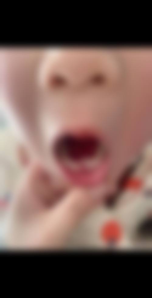 四、贝儿壹颗芽口腔门诊部特色项目