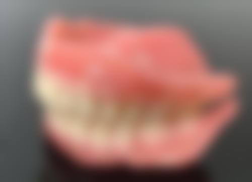 根管治疗的牙齿牙龈出血怎么回事？或与治疗刺激、炎症残留、操作不当及全身疾病等因素有关！ 