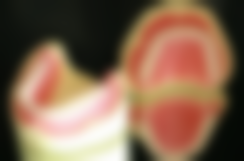 牙齿美白贴面的操作过程与术后护理