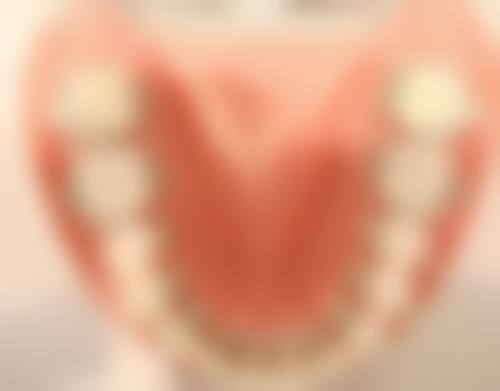 美观度比拼:谁能更接近天然牙齿