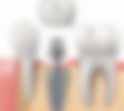 六、山东烟台莱阳韩雷口腔口碑如何？