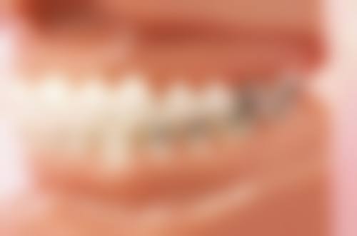 牙齿有结石洗牙能解决吗？多数情况有效，但严重顽固结石需配合治疗，洗牙还可防牙周病！ 