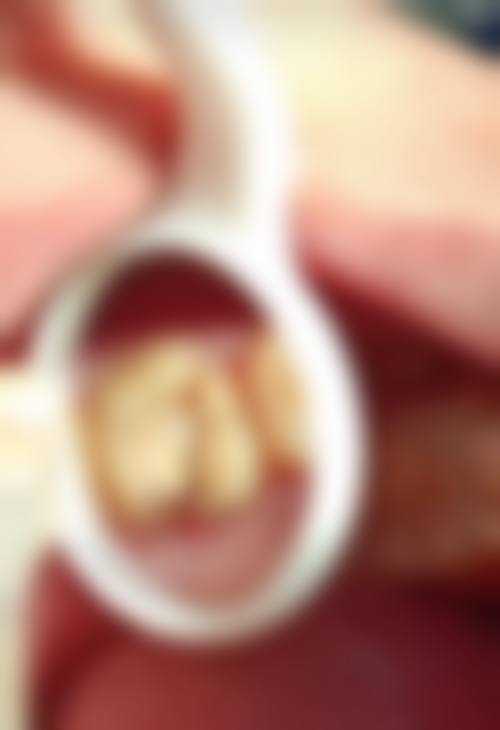 六、广东广州运沁口腔门诊口碑如何？