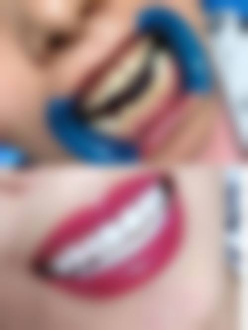 六、青岛华诺口腔诊所口碑如何?