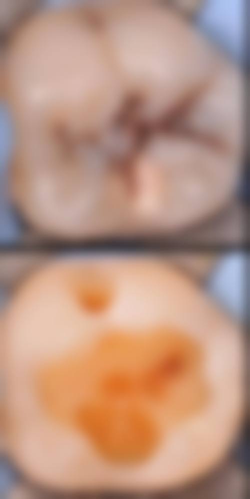 六、铜仁德江贝齿美口腔门诊部口碑如何？