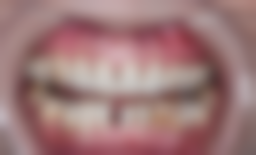 五、贵州黔南都匀雅康口腔收费价格表