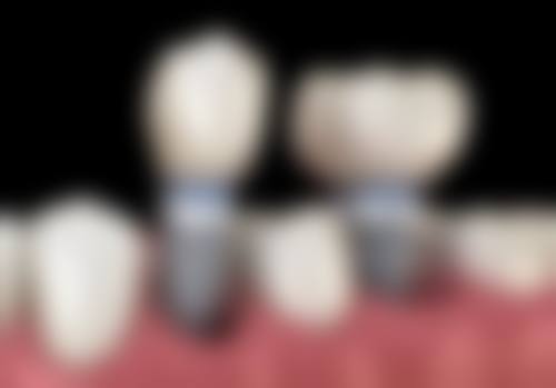 二、广州雅健口腔门诊正规吗？来看医院资质信息