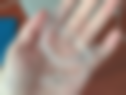 五、沈阳欢乐仁爱口腔李江明医生技术怎么样？