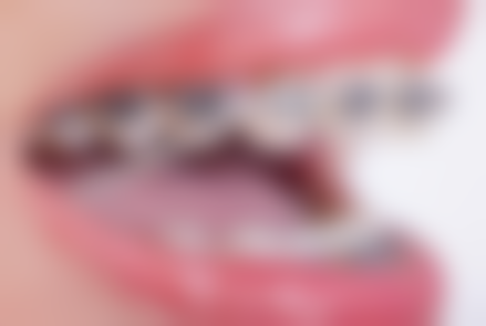 五、乌鲁木齐小白兔口腔谭欣医生技术怎么样?