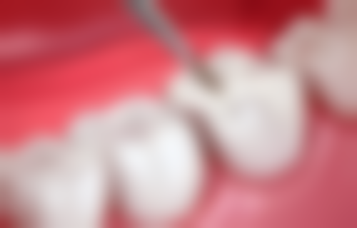 五、赣州金铂利口腔门诊收费价格表