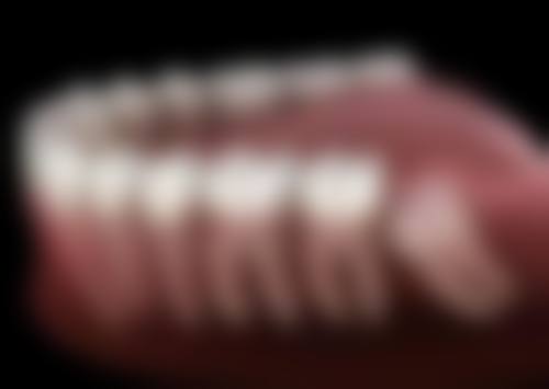 三岁左右小孩补牙的方法和材料讲究