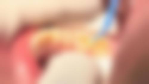 五、江西 南昌朝东口腔收费价格表