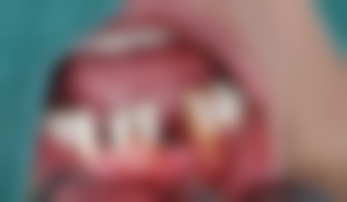 六、台州高伟口腔口碑如何？