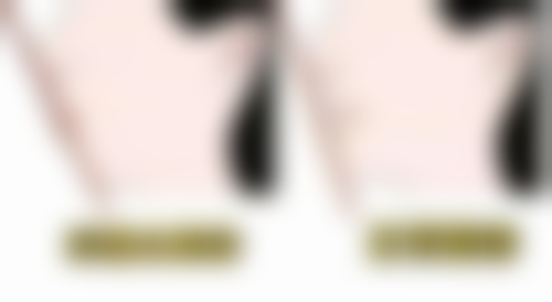 五、黄在浩医生技术怎么样？