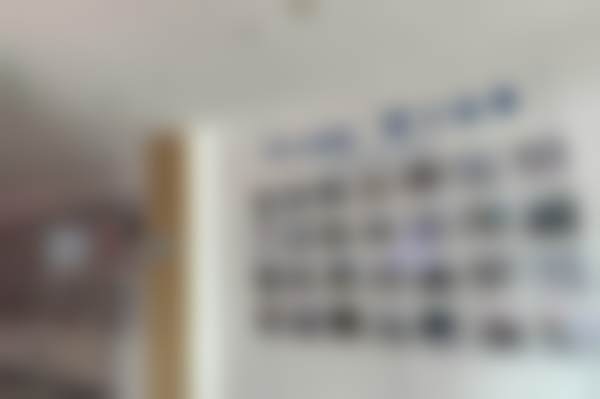 西宁中诺口腔医院做【全瓷牙冠】爱尔创镶牙的优势