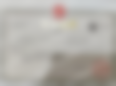 仕诺康种植牙的稳定性优势