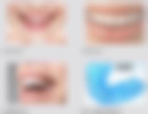 七、乌鲁木齐美奥口腔张圣玄医生怎么预约？