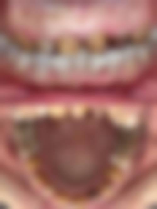 四、南通海安医博御府口腔特色项目