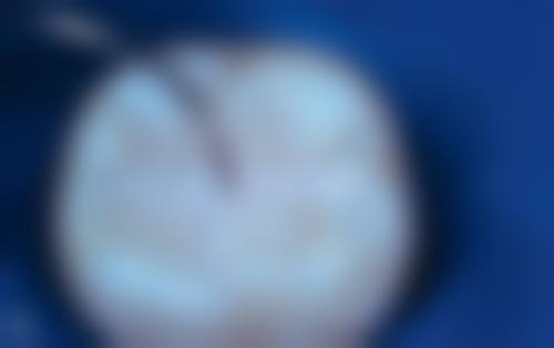 八、海南海口小蛀牙口腔怎么预约？