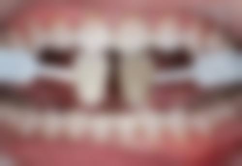 五、深圳夕诺于洪林医生技术怎么样？