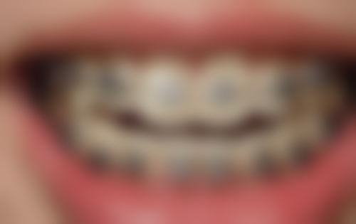 六、竹山永信雅美赵国伟医生口碑评价及真人实例反馈