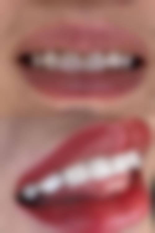 五、沈阳皇姑银山博冠口腔收费价格表