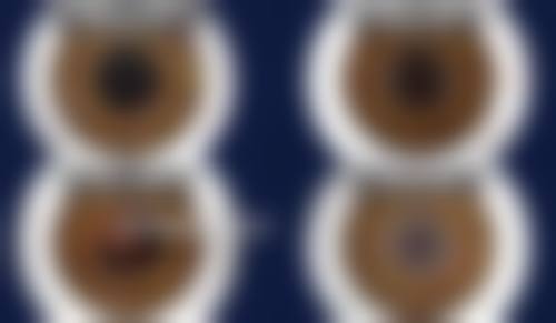 龙岩市第二医院眼科项目价格