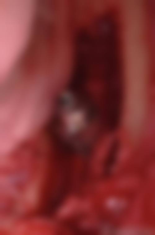 山东潍坊坊子臻美口腔预约挂号方式。