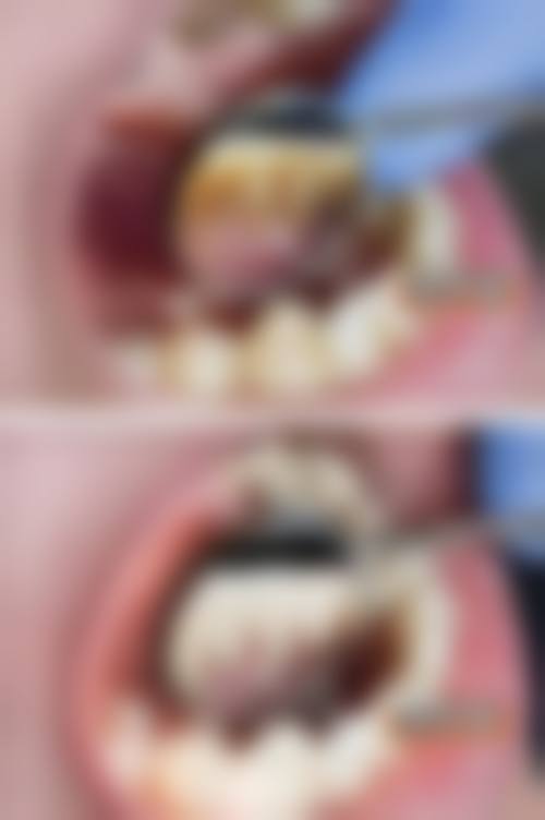 五、恒牙康口腔收费价格表