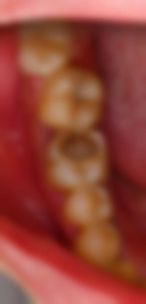 宁阳华诺口腔医院擅长项目。