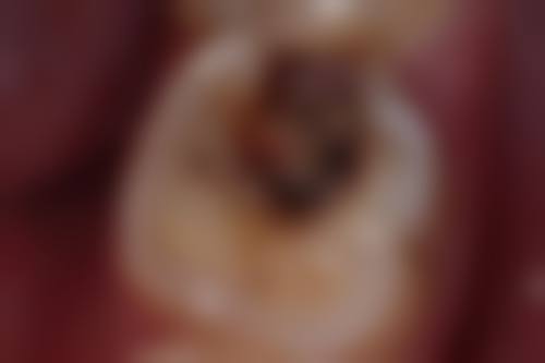 宁阳华诺口腔医院治疗反馈与口碑评价。