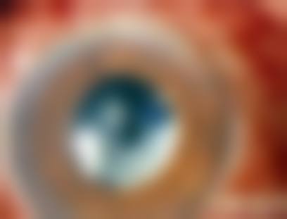 龙岩市第二医院眼科乘车路线