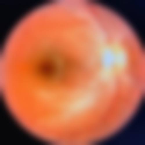 龙岩市第二医院眼科简介