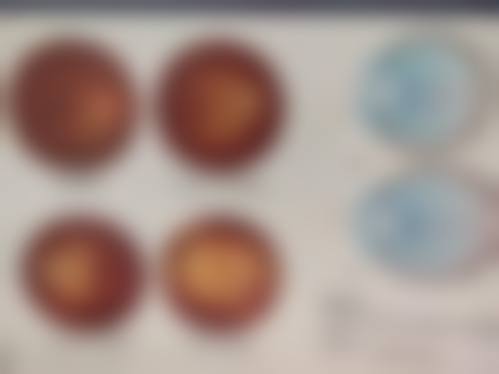 龙岩市第二医院眼科的设备情况