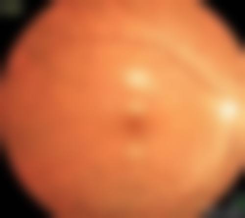 王伟中医生的技术实力