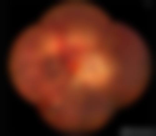 龙岩市第二医院眼科预约方式