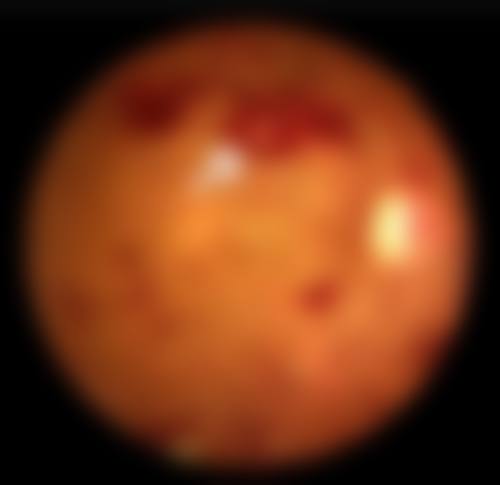 龙岩市第二医院眼科口碑评价