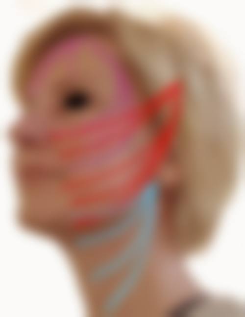 上海莱铄医疗美容门诊部擅长项目。