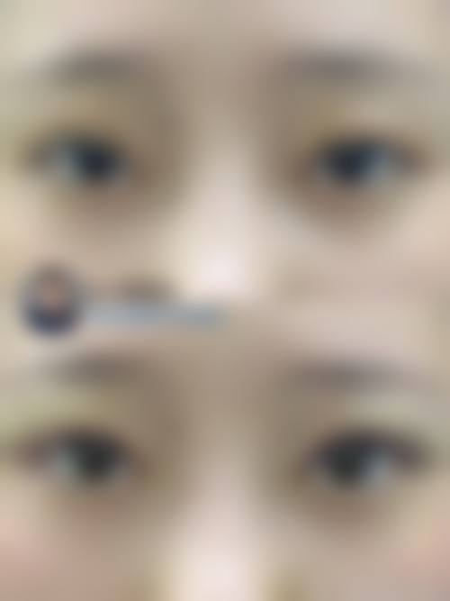 龙岩市第二医院眼科治疗反馈与口碑评价。