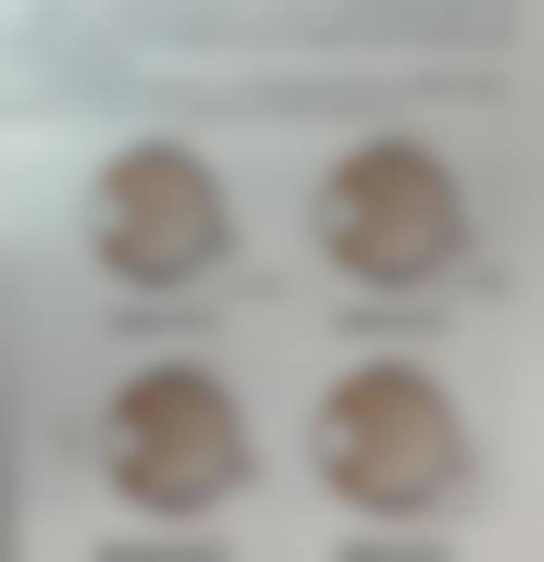 宣汉蒲晶眼科医院治疗反馈与口碑评价。
