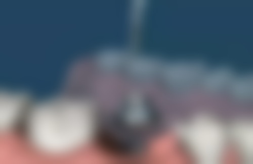 三、海口奥雅格口腔诊所的挂号方式与地址