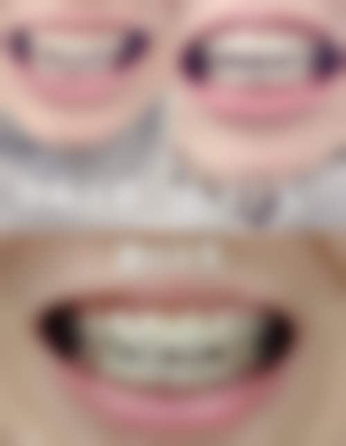 七、海口奥雅格口腔诊所的患者评价