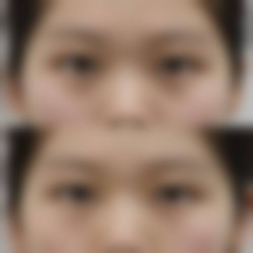 保定悦美医疗美容预约挂号方式。