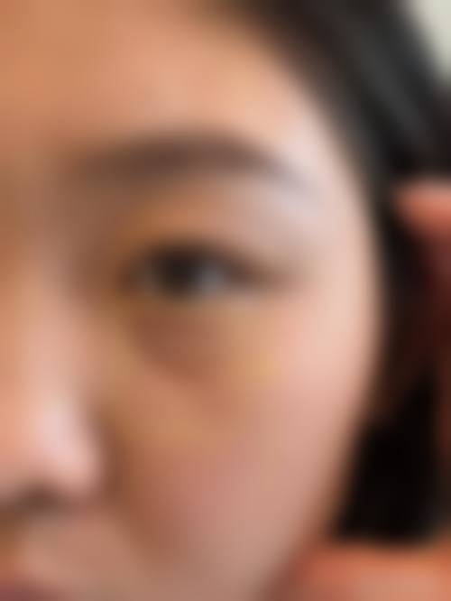 保定悦美医疗美容擅长项目。