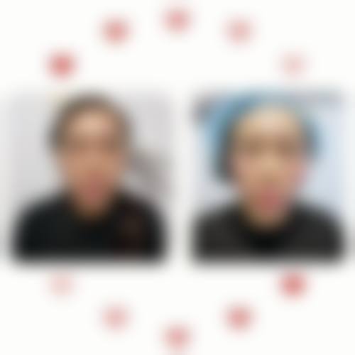 保定悦美医疗美容地理位置便于到院。