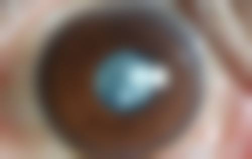 北京市垂杨柳医院眼科门诊营业时间。
