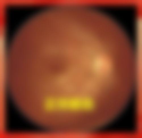 鹤岗明仁眼科医院设备优势