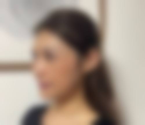 保定悦美医疗美容医生团队经验稳定。